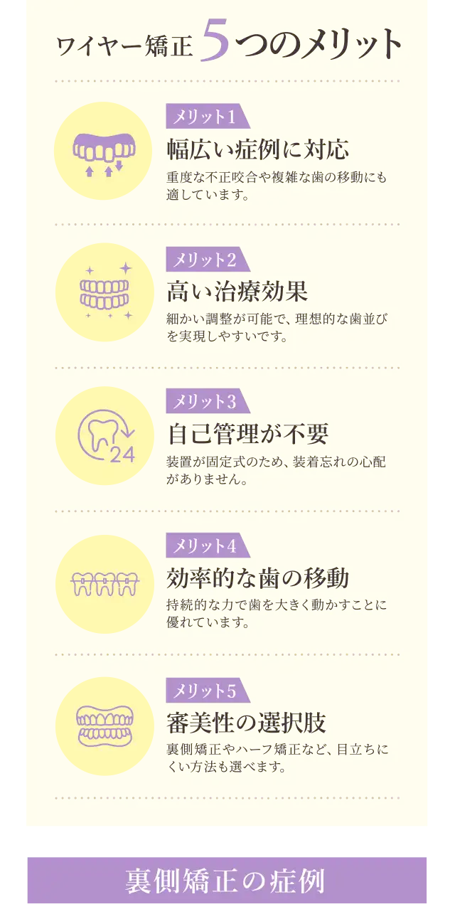 ワイヤー矯正の５つのメリット