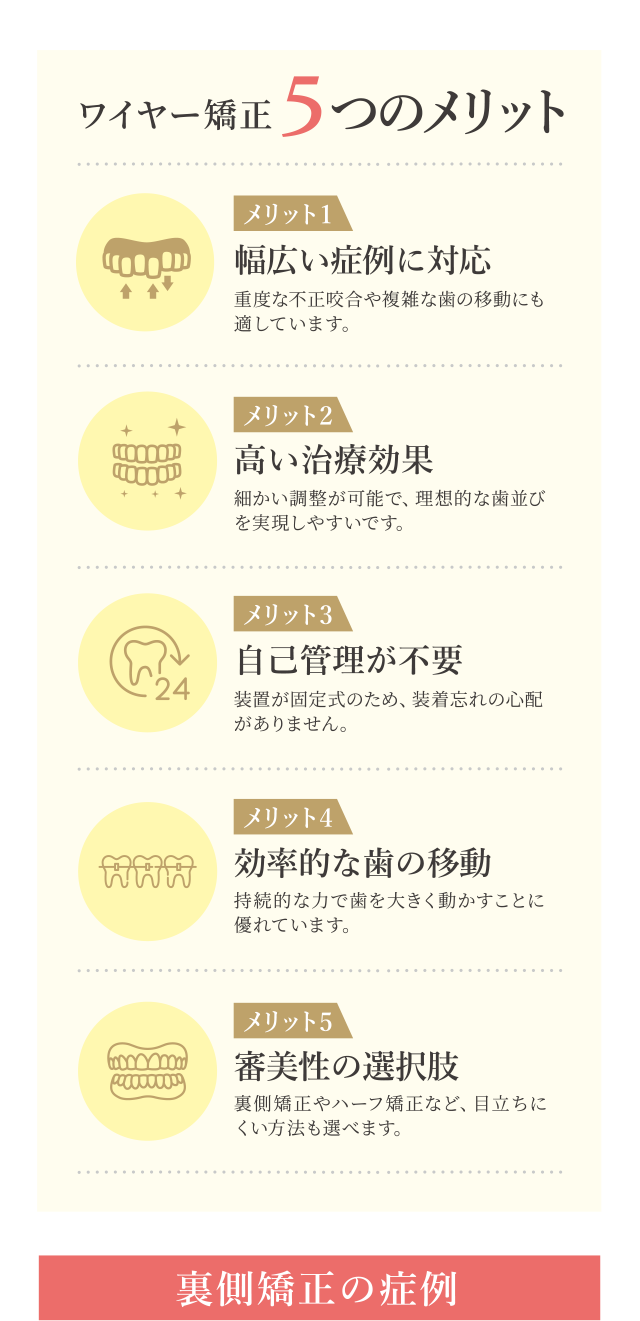 ワイヤー矯正の５つのメリット